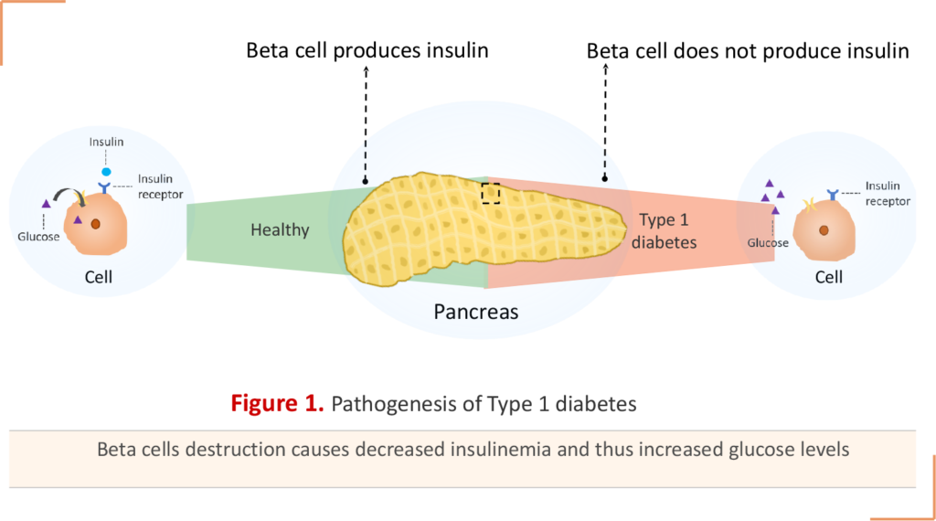 Pathogenesis-of Type-1 Ddiabetes