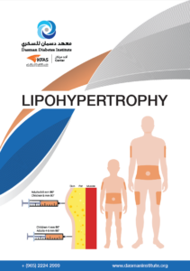 Lipohypertrophy