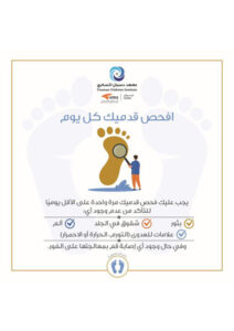 Summer Tips For Feet – Arabic